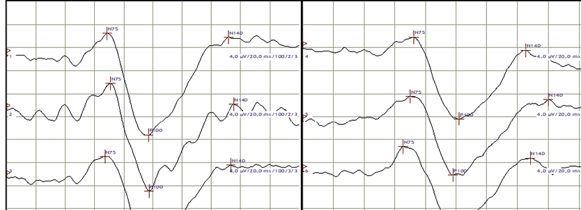 Gráfico, Gráfico de líneas

Descripción generada automáticamente